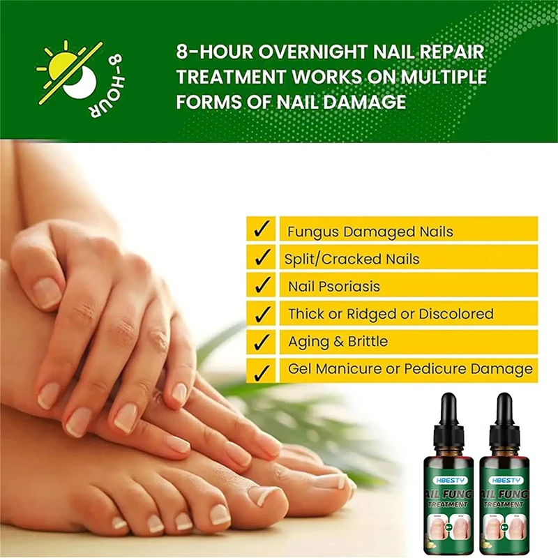 7Days Nail Fungus Treatment Serum Ginger Anti-infective Paronychia Onychomycosis Toe Foot Nail Fungal Repair Gel Hand Foot Care