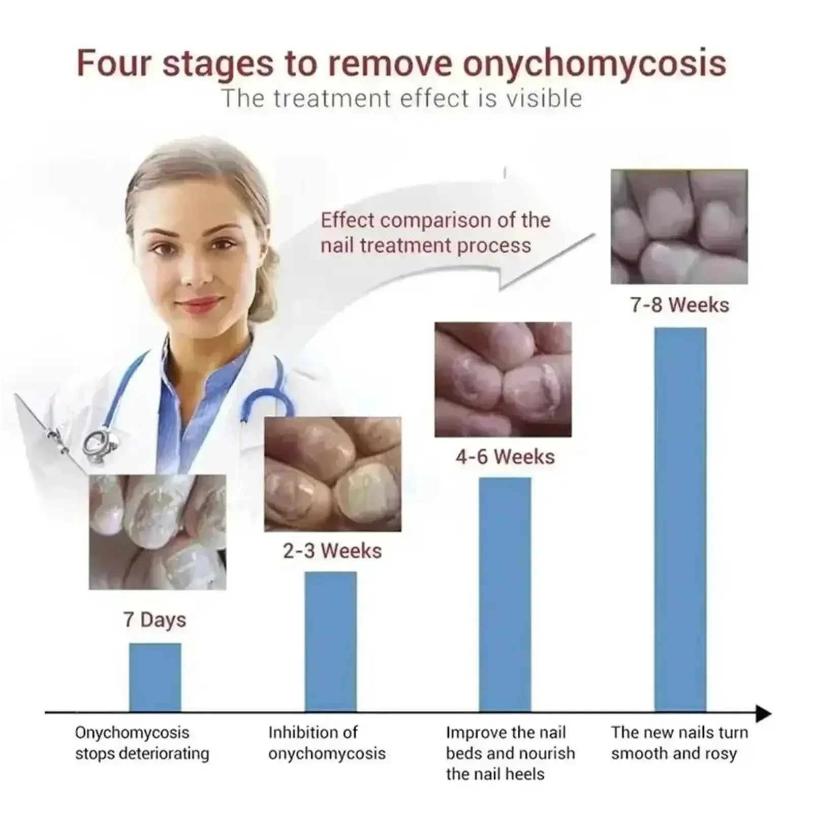 7Days Nail Fungus Treatment Serum Ginger Anti-infective Paronychia Onychomycosis Toe Foot Nail Fungal Repair Gel Hand Foot Care