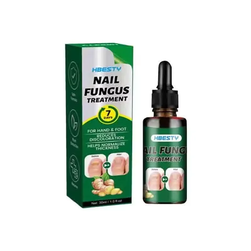 7Days Nail Fungus Treatment Serum Ginger Anti-infective Paronychia Onychomycosis Toe Foot Nail Fungal Repair Gel Hand Foot Care