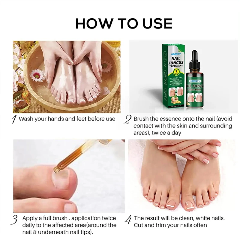 7Days Nail Fungus Treatment Serum Ginger Anti-infective Paronychia Onychomycosis Toe Foot Nail Fungal Repair Gel Hand Foot Care