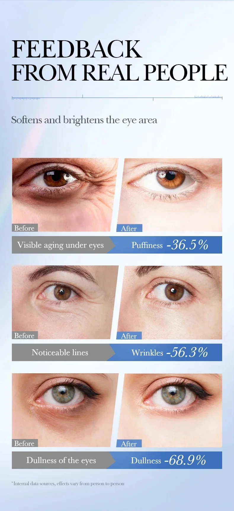 Caviar Eye Bag Removal Cream Hyaluronic Acid Anti-Wrinkle Firming Skin Fade Fine Lines Anti Dark Circle Puffiness Eye Care 20g