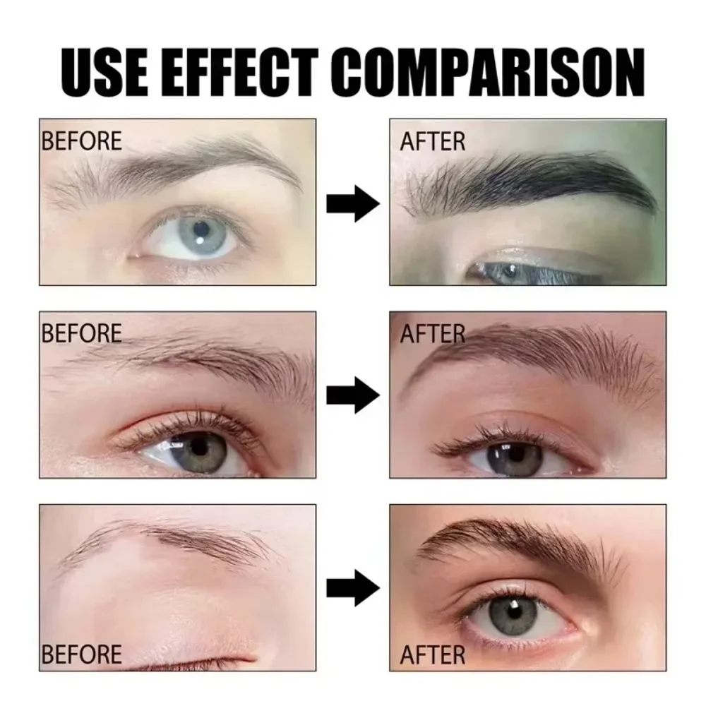 Eyebrow Growth Serum Eyelash Hair Growth Anti Hairs Loss Product Prevent Baldness Fuller Thicker Lengthening Eyebrow Makeup 30ml Eyebrow Growth Serum Eyelash Hair Growth Anti Hairs Loss Product Prevent Baldness Fuller Thicker Lengthening Eyebrow Makeup 30ml