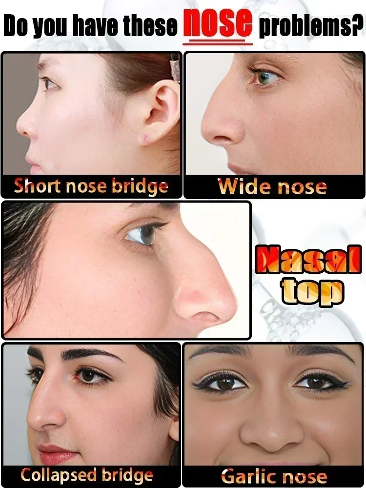 Nose Lift Up Essential Oil Shaping Nasal Bone Remodeling Natural Care Thin Small Nose Up High Heighten Rhinoplasty Rhinoplasty