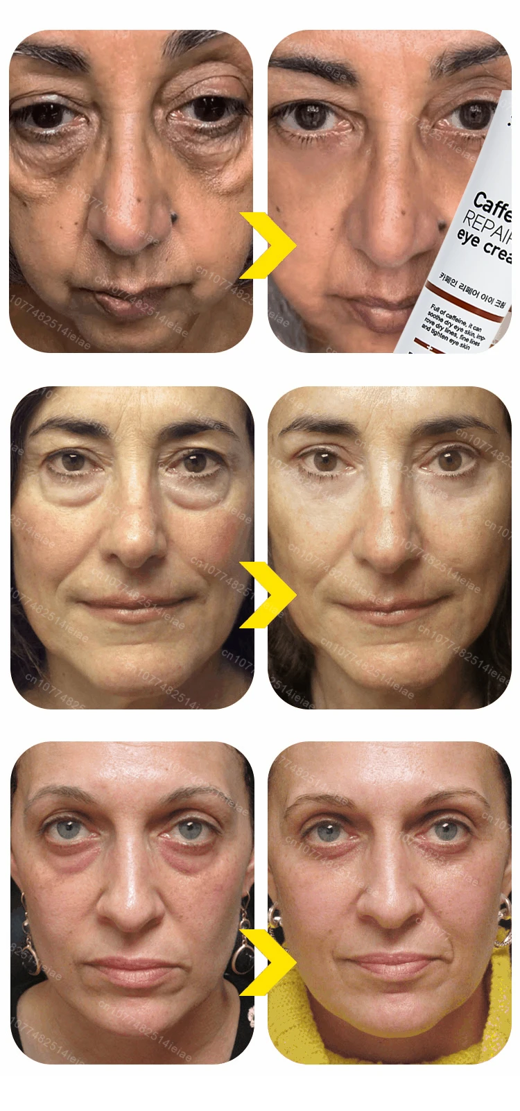 Instantly removes under eye bags, reduces fine wrinkles, improves skin elasticity, eliminates dark circles, brightens the eye ar