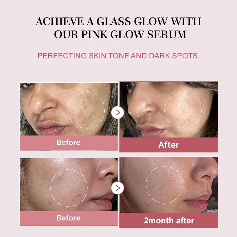 Complex Peptide Acne Serum PDRN Collagen Shrink Pores Fade Melanin Smooth Brightening Skin Korean Skincare Products